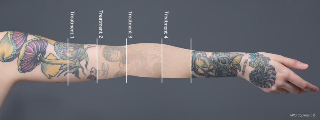 Tattoo Arm-AW3 Copyright