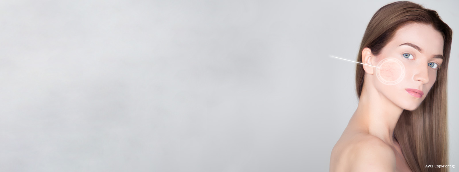 VeinRemovalCopyright