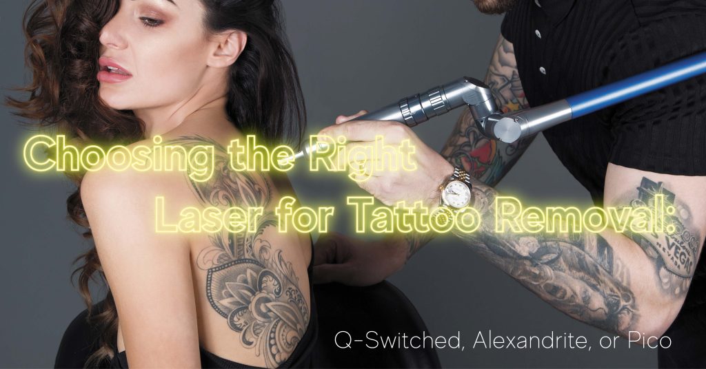 How to choose right laser tattoo removal