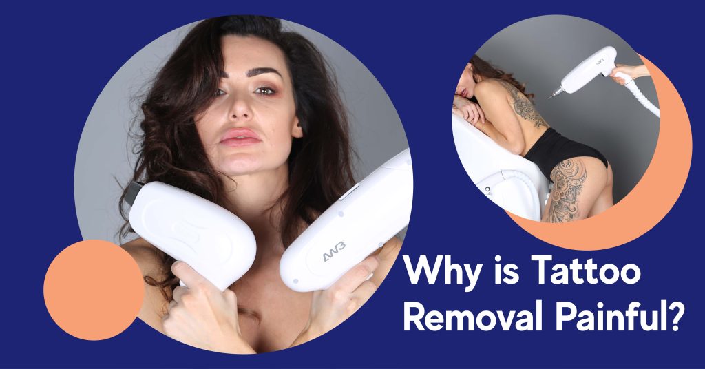 why is tattoo removal painful?