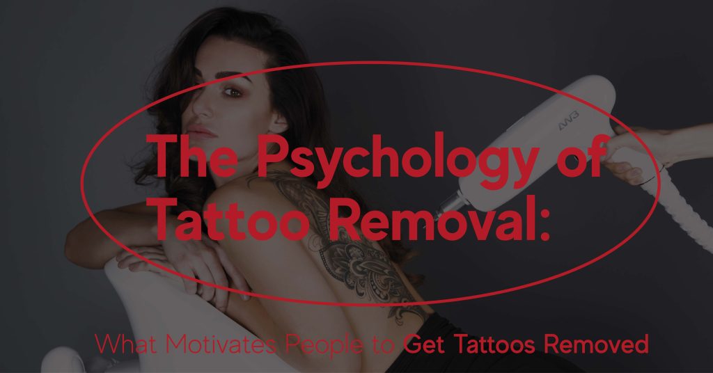 The Psychology behind Tattoo Removal