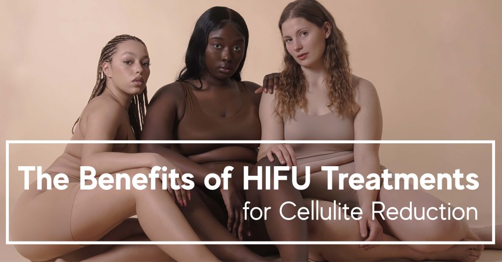 Benefits of hifu treatments in celluite reduction