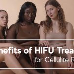 Vorteile von Hifu-Behandlungen bei der Reduzierung von Cellulite