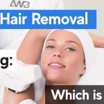 laser hair removal vs waxing