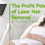 Profit Potential of Laser Hair Removal