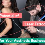 the profit potential for tattoo removal business in the UK