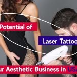 Laser Tattoo Removal Business profit