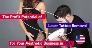Laser Tattoo Removal Business profit
