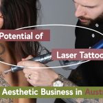profit potential of laser tattoo removal business in Australia