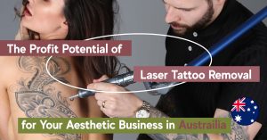 profit potential of laser tattoo removal business in Australia