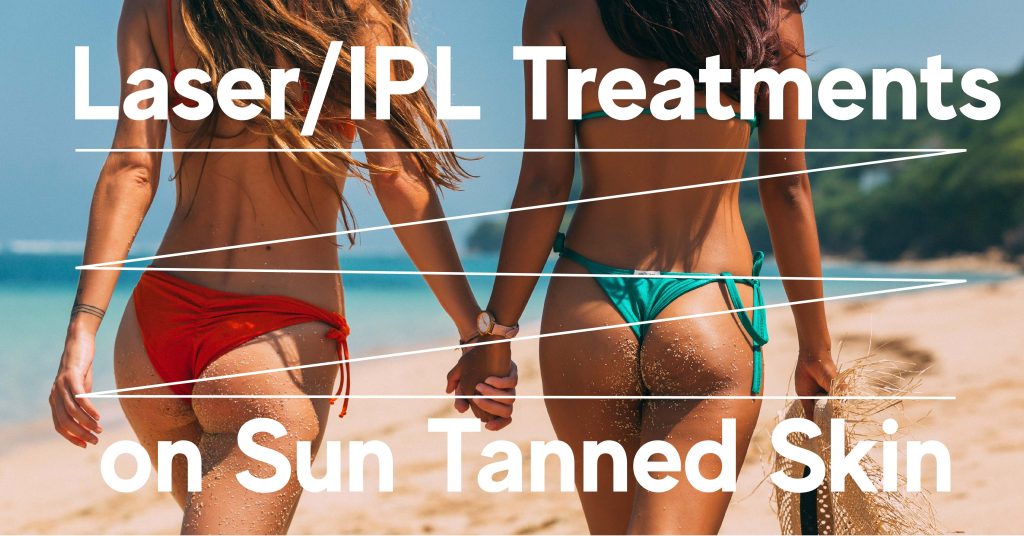 phương pháp điều trị ipl cho làn da rám nắng