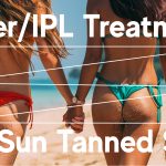 ipl treatments on tanned skin