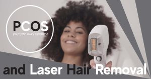 PCOS and Laser Hair Treatment