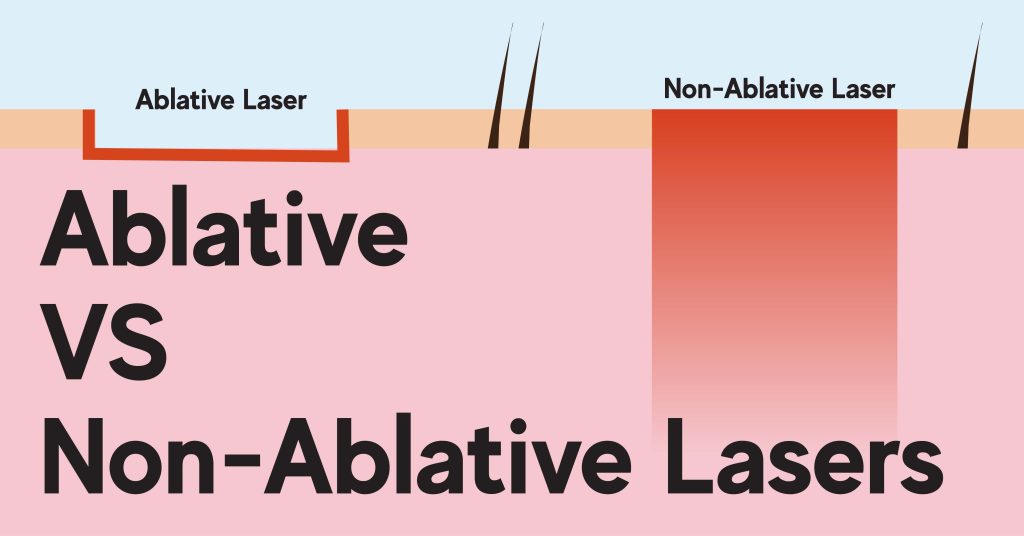 Ablative Laser vs Non-Ablative | AllWhite Laser | AW3®