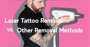 Laser tattoo removal vs other tattoo removal methods