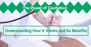 power of cavitation