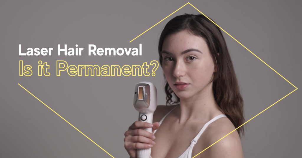 Is Laser Hair Removal Permanent AllWhite Laser AW3