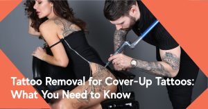 tattoo removal for cover up tattoo