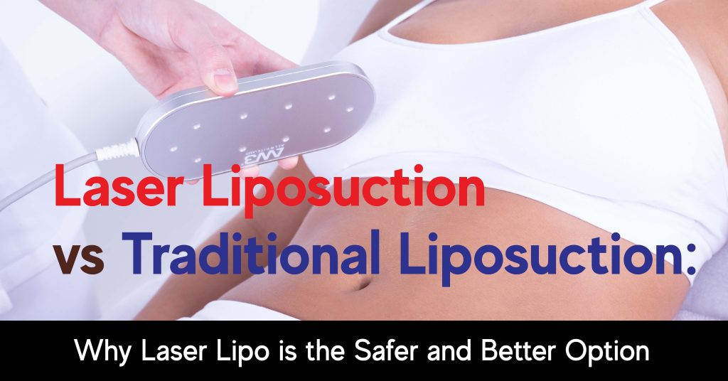 Liposuccion au laser vs liposuccion traditionnelle