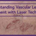 laser treatment for vascular lesions