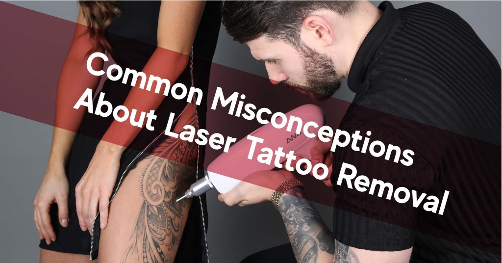 common misconception about laser tattoo removal
