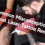 common misconception about laser tattoo removal