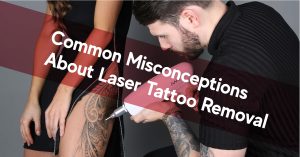 common misconception about laser tattoo removal