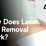How does laser hair removal work?