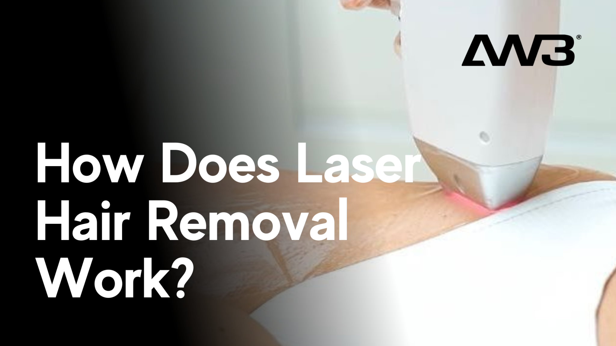 How Laser Hair Removal Works AllWhite Laser AW3®