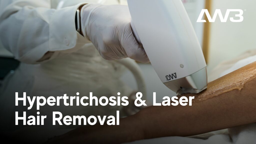 Hypertrichosis and Laser Hair Removal