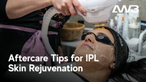 IPL skin rejuvenation aftercare