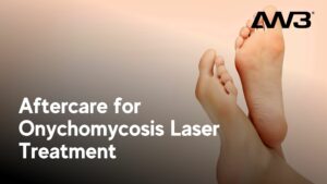 aftercare for nail fungus