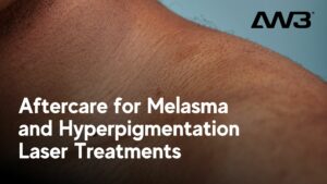 Aftercare for Melasma and Hyperpigmentation Laser Treatments
