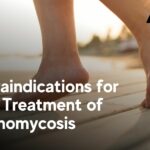 Contraindications for Laser Treatment of Onychomycosis