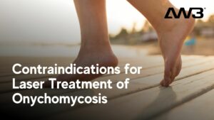 Contraindications for Laser Treatment of Onychomycosis