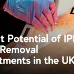 IPL Hair Removal Profit Potential UK
