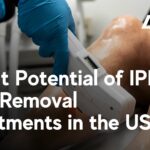 IPL Hair Removal Profit Potential USA