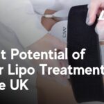 Laser Lipo Profit Potential UK