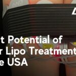 Laser Lipo Profit Potential USA