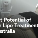 Laser Lipo Profit Potential Australia