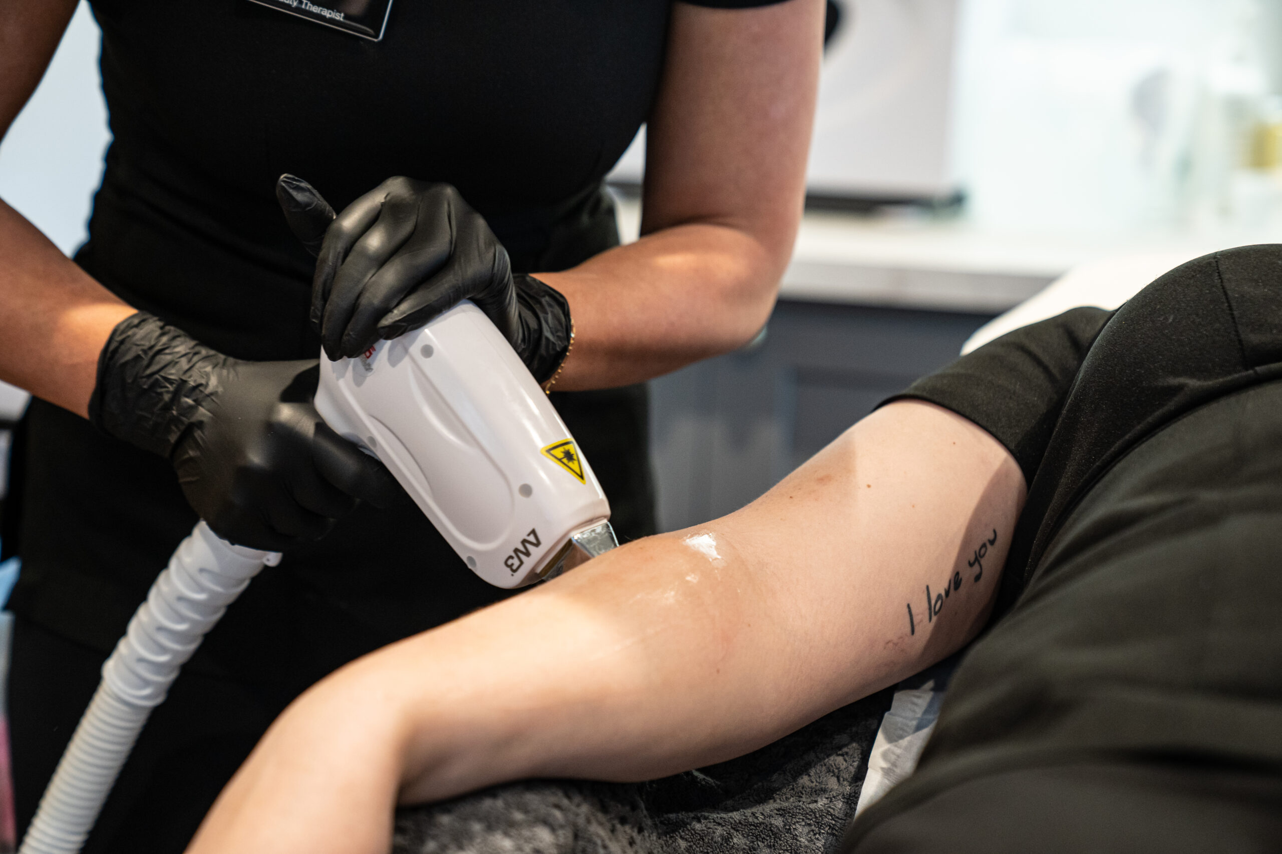 Laser Hair Removal and Pigmentation