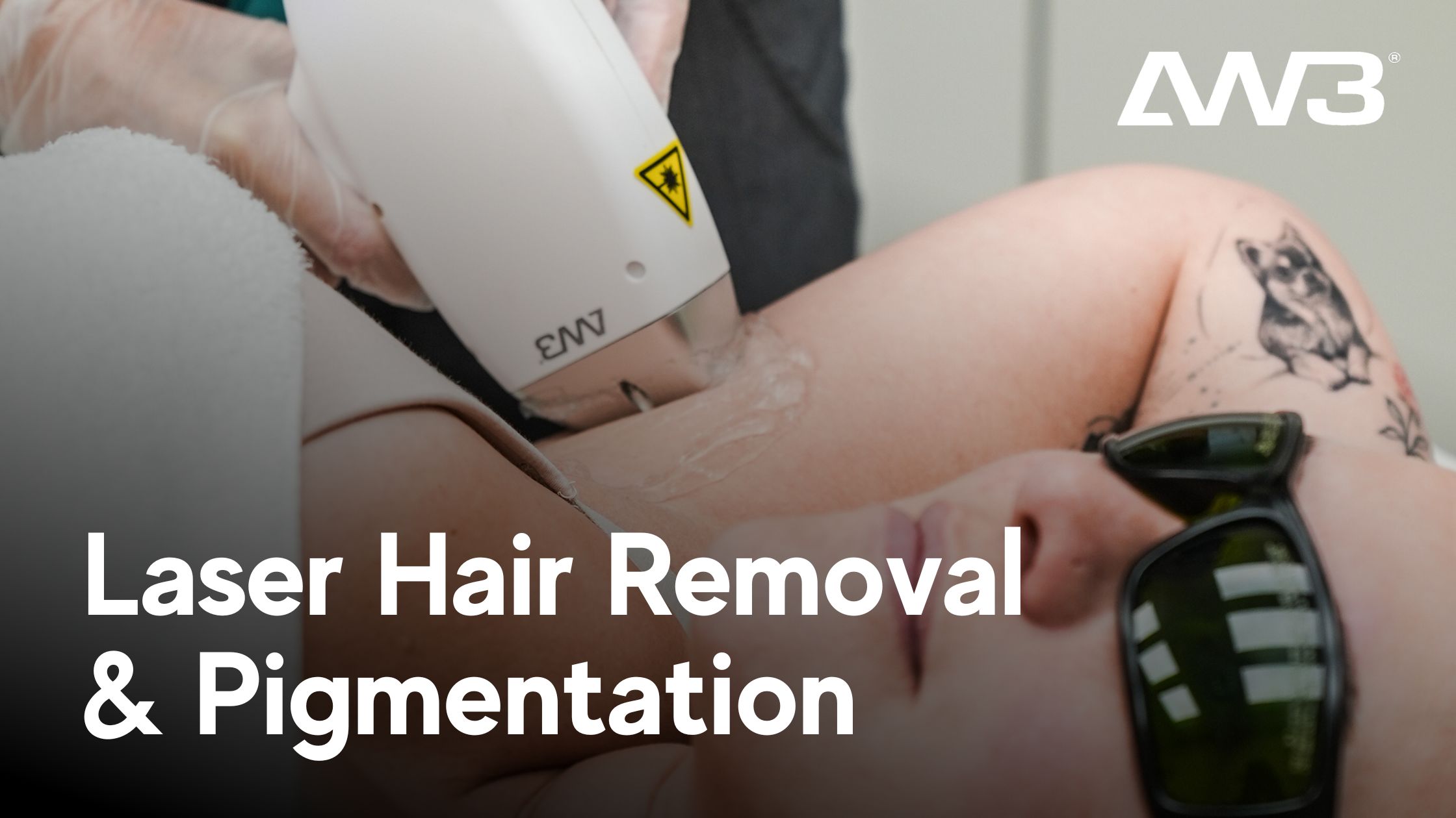 Laser Hair Removal and Pigmentation