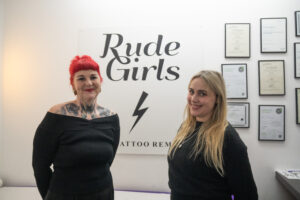Rude Girls Laser Removal